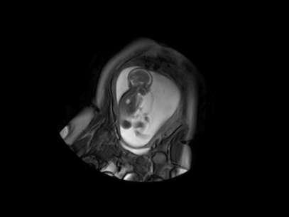 Cientistas britânicos querem usar scanner de cérebro de bebês para identificar potenciais doenças Foto: Centre for the Developing Brain/Divulgação / BBCBrasil.com