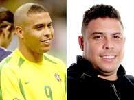 Veja Ronaldo antes e depois da Copa de 2002 Foto: Getty Images