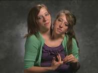 Documentário mostra 'vida normal' de gêmeas coligadas dos EUA