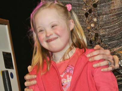 A síndrome de Down é causada pela presença de três cromossomos 21, ao invés de dois Foto: Getty Images