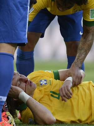 David Luiz fraturou nariz em choque com Thiago Silva Foto: AFP
