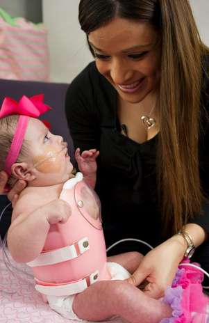 Com rara doença, Audrina Cardenas nasceu com um terço do coração para fora do corpo Foto: Texas Children's Hospital / Divulgação