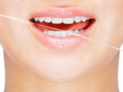 Realize uma boa higiene bucal diariamente não se esquecendo de utilizar o fio dental Foto: Shutterstock
