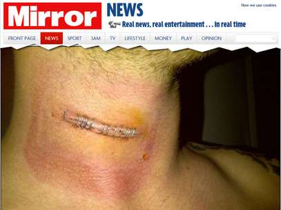 Dennis Swales quebrou o pescoço ao tentar imitar comemoração de Jurgen Klinsmann Foto: Mirror / Reprodução