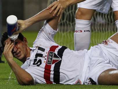 Paulo Henrique Ganso sangrou muito após bater com a cabeça no poste Foto: Reuters