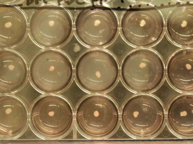 Imagem mostra brotos hepáticos desenvolvidos em laboratório Foto: Takanori Takebe / Divulgação