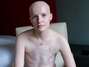Foto: David Jay/The SCAR Project  / David Jay/The SCAR Project