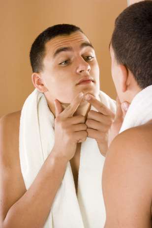 Espremer as bolinhas vermelhas só aumenta a inflamação da pele, além de propagar o aparecimento de fungos e bactérias que podem estar presentes na ponta dos dedos Foto: Shutterstock