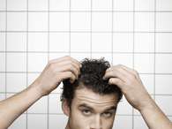 Cinquenta e sete por cento dos homens do levantamento que buscaram tratamento para queda de cabelo estão entre 18 e os 35 anos Foto: Getty Images