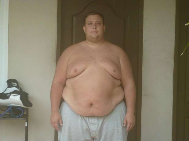 Além do peso extra, os maus hábitos alimentares também trouxeram complicações à saúde, como problemas respiratórios, inchaço das pernas e indisposição Foto: Facebook / Divulgação