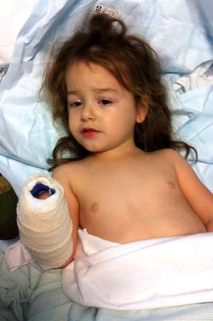 Amelia Lancaster sofre por causa de uma meningite em um hospital de Oxford, no Reino Unido. A menina surpreendeu médicos após se recuperar quando os médicos davam horas de vida para ela Foto: The Grosby Group
