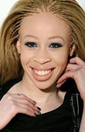 Mesmo com o preconceito, Refilwe decidiu encarar a passarela Foto: Facebook / Reprodução Mesmo com o preconceito, Refilwe decidiu encarar a passarela Foto: Facebook / Reprodução