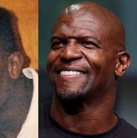 13 atores carecas famosos e seus antes e depois (com e sem cabelo)